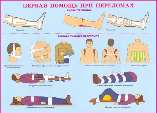  Первая помощь при переломах